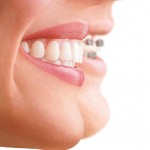 Jivadental Credited With A Gold Annotation