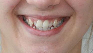 Charlotte Before
