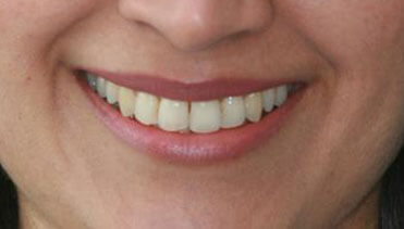 Deepa After