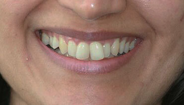 Deepa Before