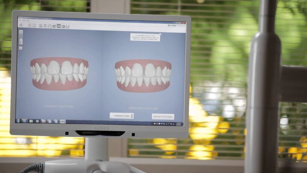 Invisalign in Kingston upon Thames