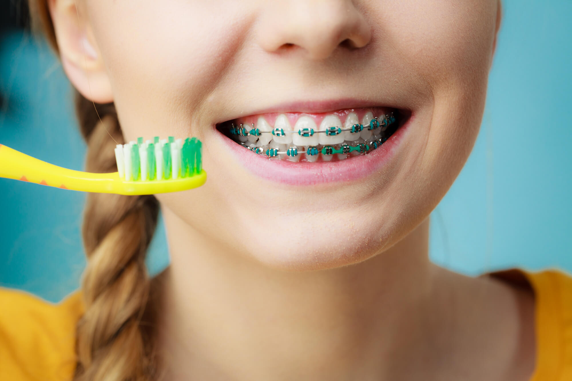 Woman with teeth braces using brush